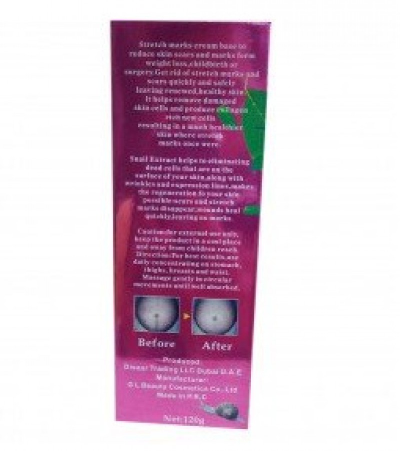 Aichun Beauty Stretch Marks Cream - 120 G