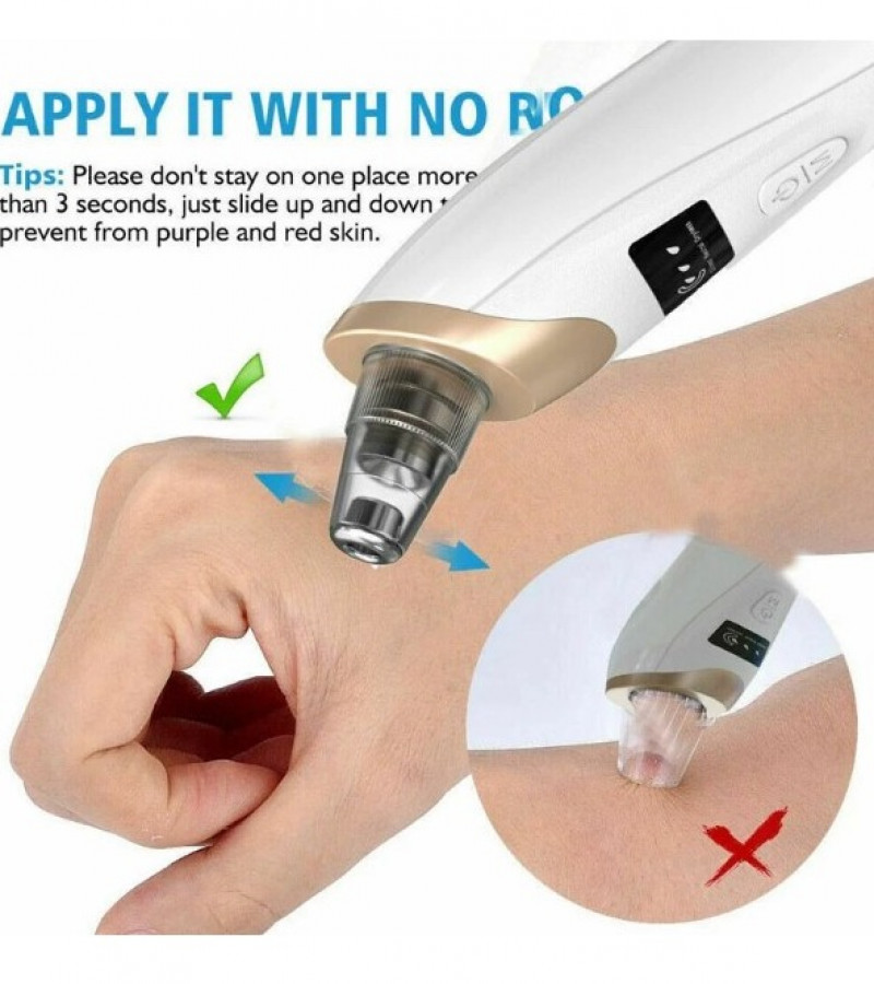 5 in 1 Blackhead Remover Machine - Derma Suction - Pimple Acne Remover - Blackhead Vacuum Machine - Deep Face Clean Pimple Popper Tool