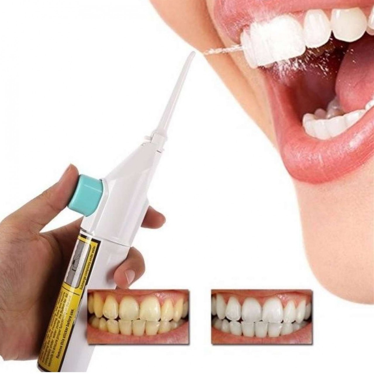 Dental Oral Water Jet Tooth Cleaning Flusher Braces