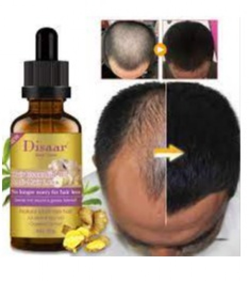 Disaar Natural Ginger Hair Care For Men And Women Hair Loss Powerful Hair Growth 30ML