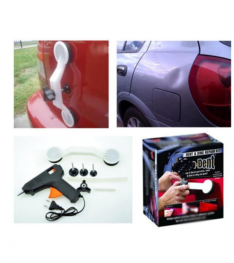 Pops A Dent Car Dent Remover Kit - Black