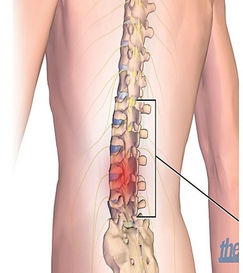 Back Pain Belt Ny48 - Need Help & Get Releif Of Backpain
