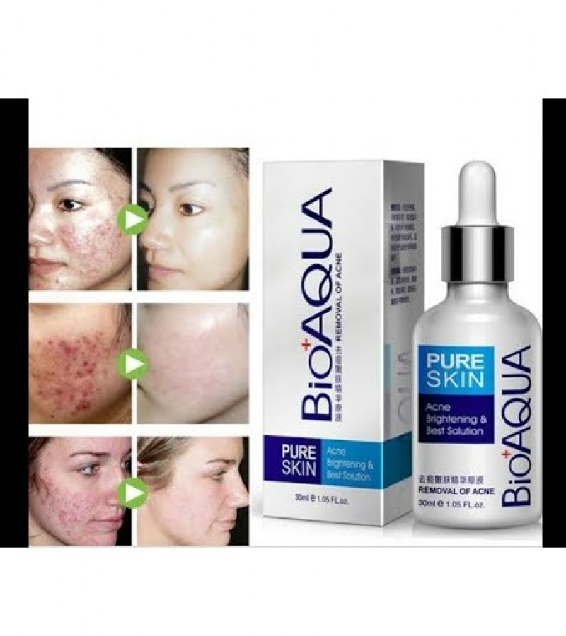 Bio Aqua Pure Skin Anti Acne Serum Facial Removal Solution Oil Control.