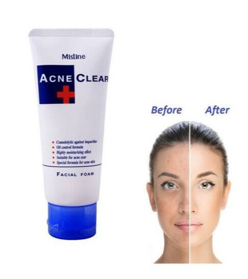 Original Mistine Acne Clear Facial Foam 85gm