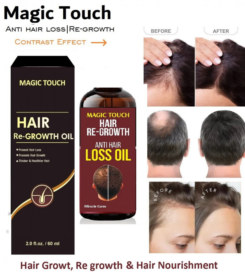 Magic Touch Hair Regrowth Oil 60ml | Anti Hair loss and Grow New Hairs