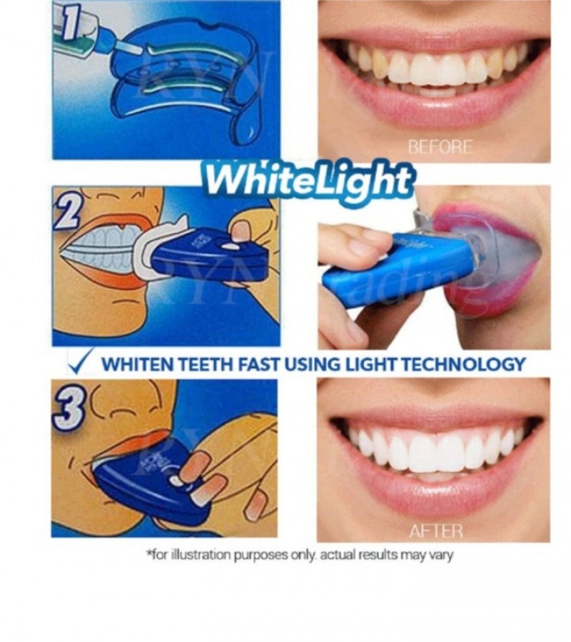 White Light Teeth Whitening System - Blue
