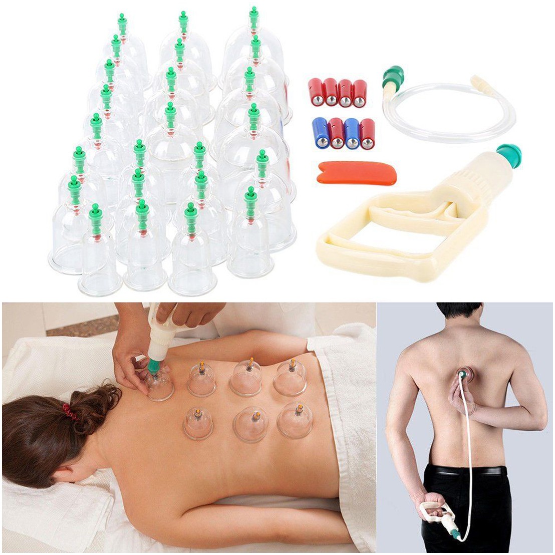 Hijama Medical Vacuum Cupping Suction Therapy Device Set (12 Cups)