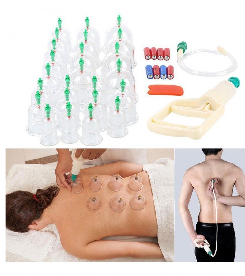 Hijama Medical Vacuum Cupping Suction Therapy Device Set (12 Cups)