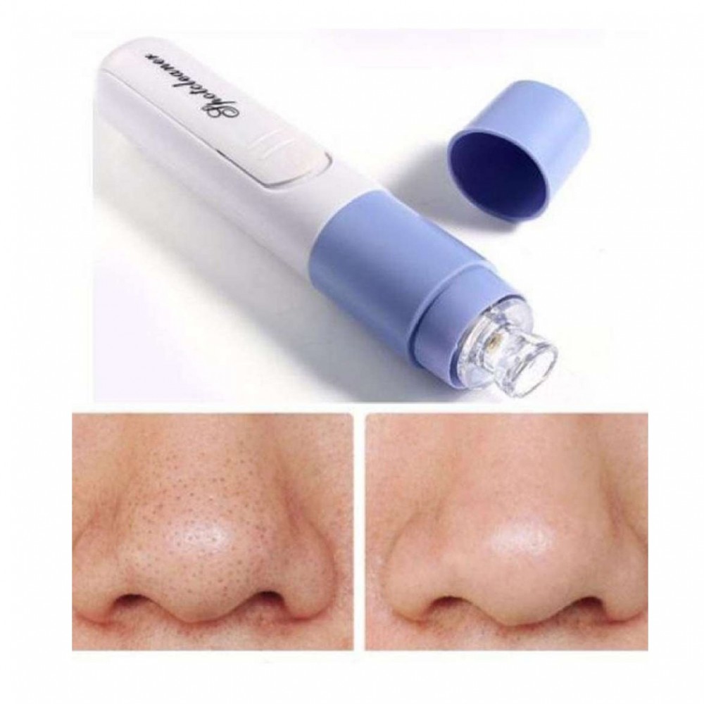 Portable Electronic Facial Skin Cleansing Blackhead Remover Machine Women Makeup Zit Acne Pore Clean