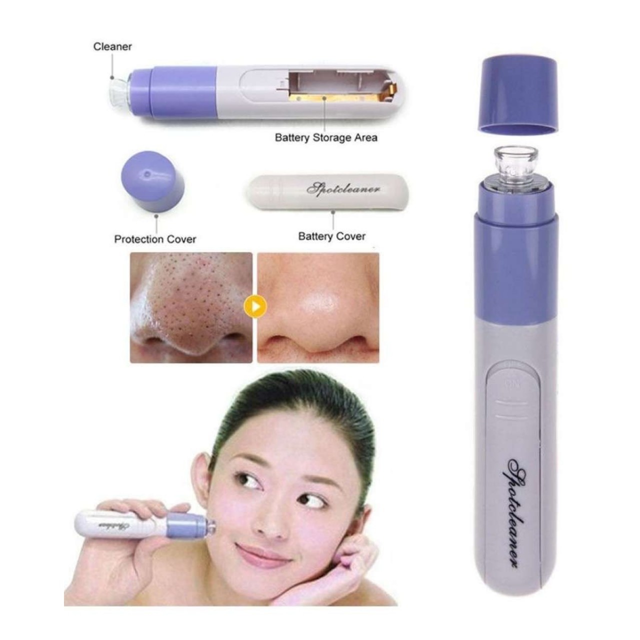 Portable Electronic Facial Skin Cleansing Blackhead Remover Machine Women Makeup Zit Acne Pore Clean