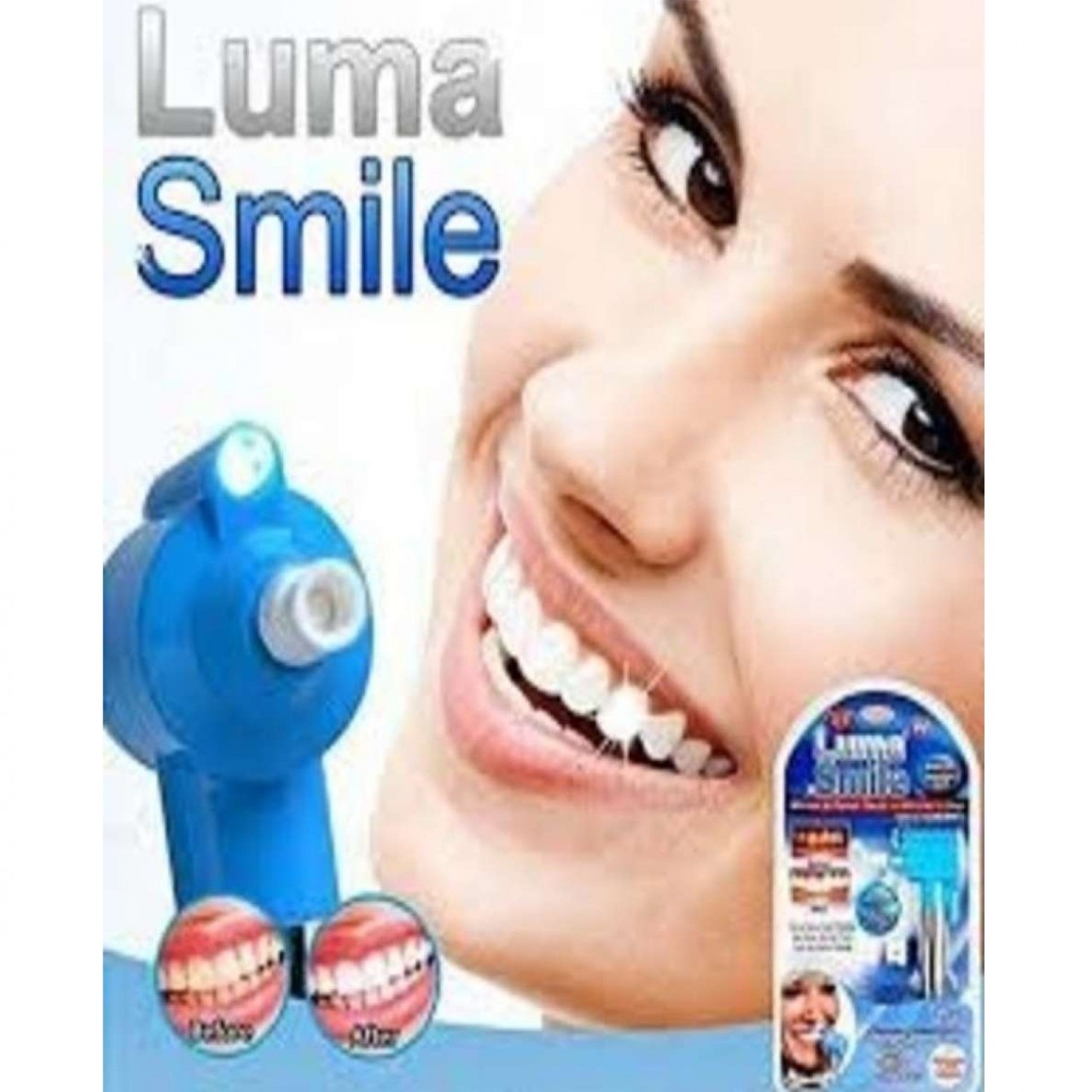 Teeth Polish Whitening Smile Kit For Pearl Teeth