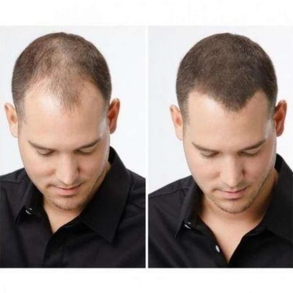 Top Shops - Caboki Hair Fiber