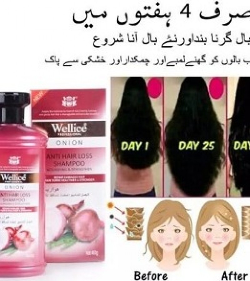 Wellice Onion Anti Hair Loss Shampoo - 400g