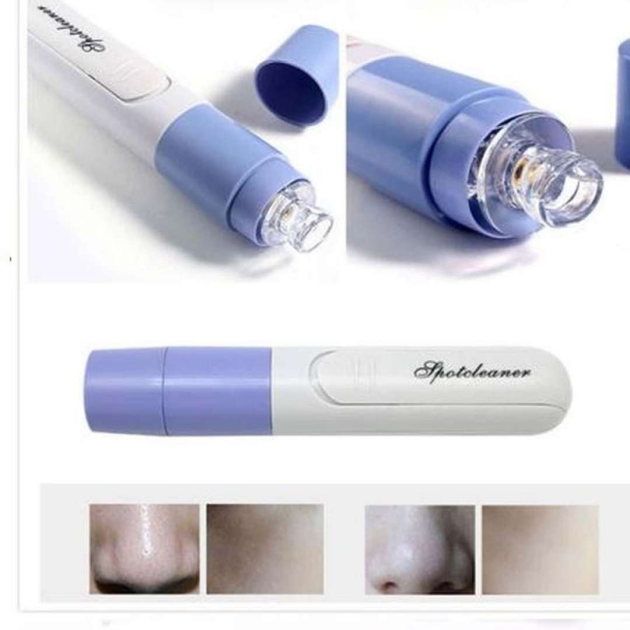 Mini Portable Electric Facial Pore Cleaner