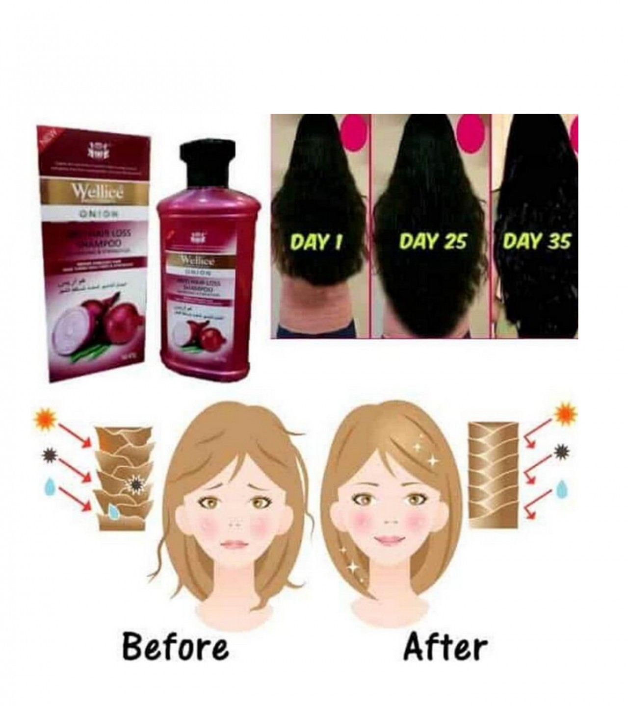 Wellice Professional Onion Shampoo Anti Hair Loss Shampoo - Organic Shampoo - 400g