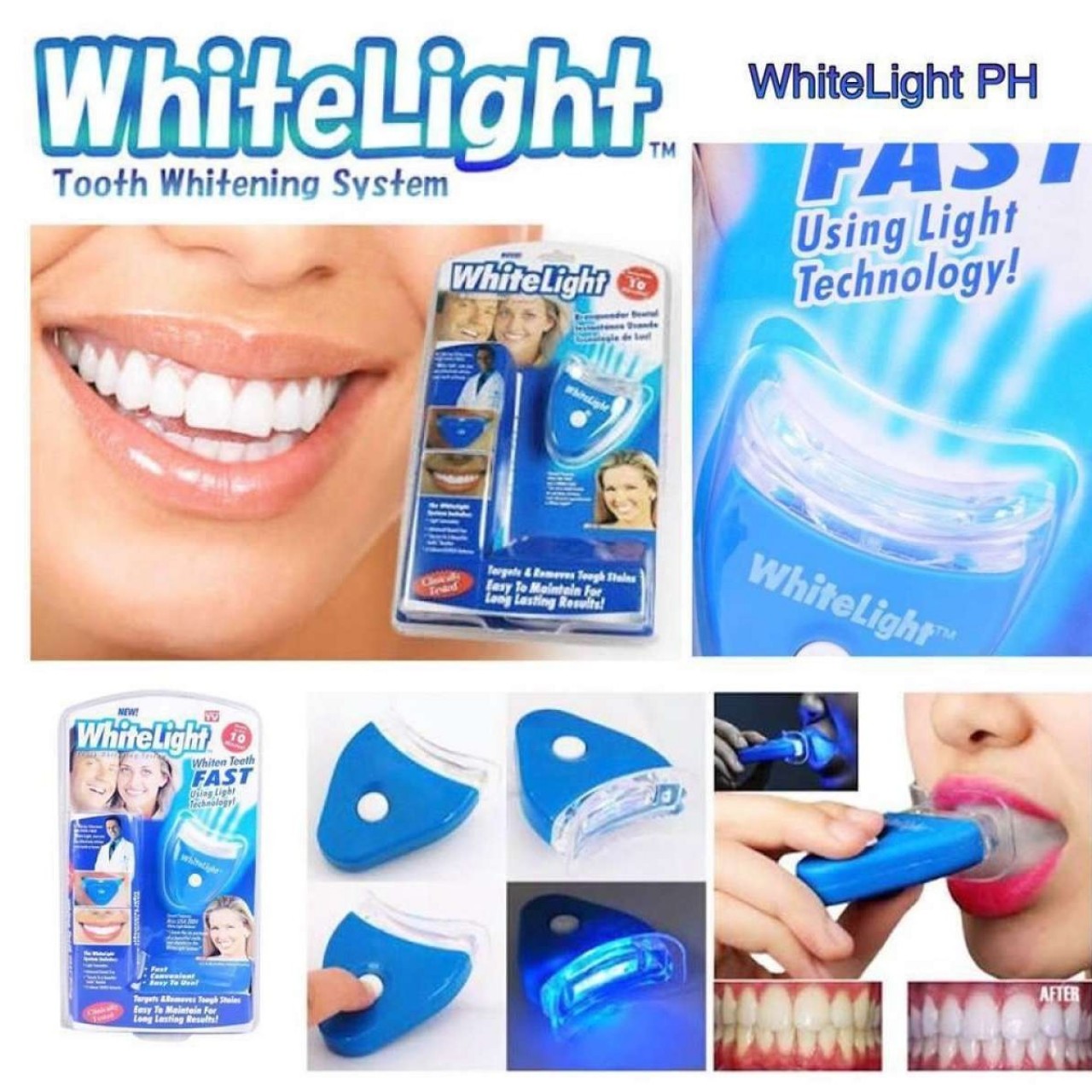 White Light Teeth Whitener
