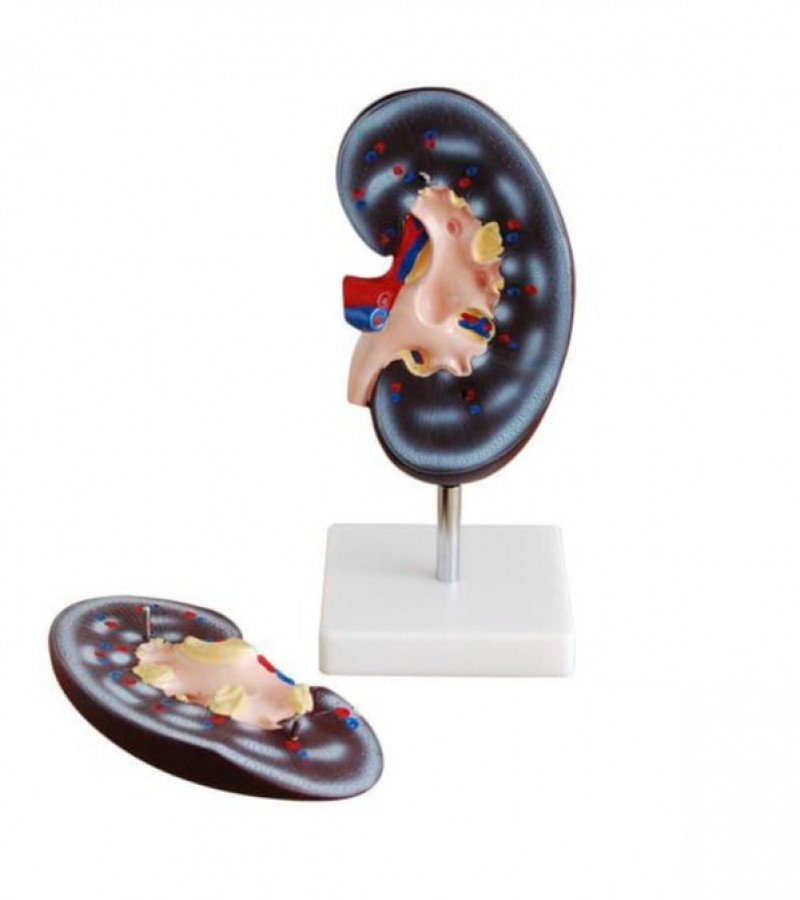 Human Kidney Anatomy Model 2 parts | Human Kidney Teaching Model